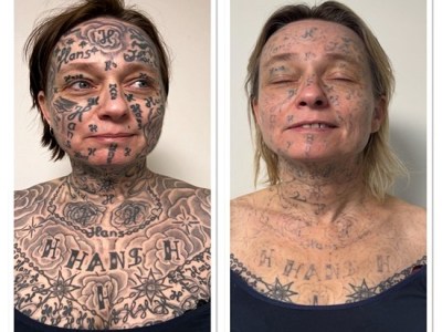 Spijt van Tattoo start actie om gedwongen tatoeages bij vrouwen te&nbsp;verwijderen